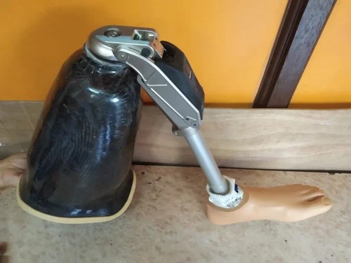 Prosthetic leg with mechanical knee joint